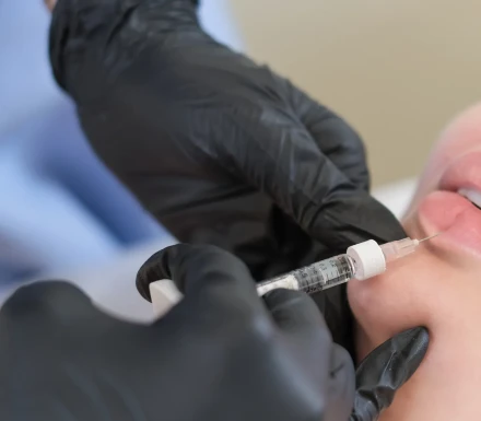 beauty specialist administering a lip volumizing s 2025 02 22 16 15 57 utc